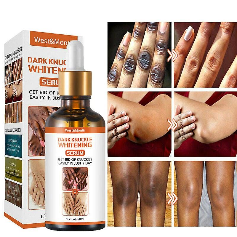 Dark Knuckle Whitening Serum Hand Elbow Knee Brightening Serum In Polokwane City And Saldanha Town Call ☏ +2771 073 2372 Get Rid Of Tattoos And Dark Spots In Montagu Town In South Africa,This whitening serum will help address issues like dark spots, hyperpigmentation, sun damage, and skin tone unevenness, leaving you with a beautiful, smooth, radiant, and even skin tone.Made with natural quality vegetable ingredients. This product is rich in collagen, which makes the skin fully nourished. And repair skin damage.Tranexamic acid has been scientifically proven to renew the skin, it reduces the formation of melanin pigment. It is the best agent to renew the skin, reduce freckles, blemishes and dark spots.